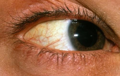 肝不好不能喝蜂蜜？提醒：想要肝臟健康，3食物盡量少碰