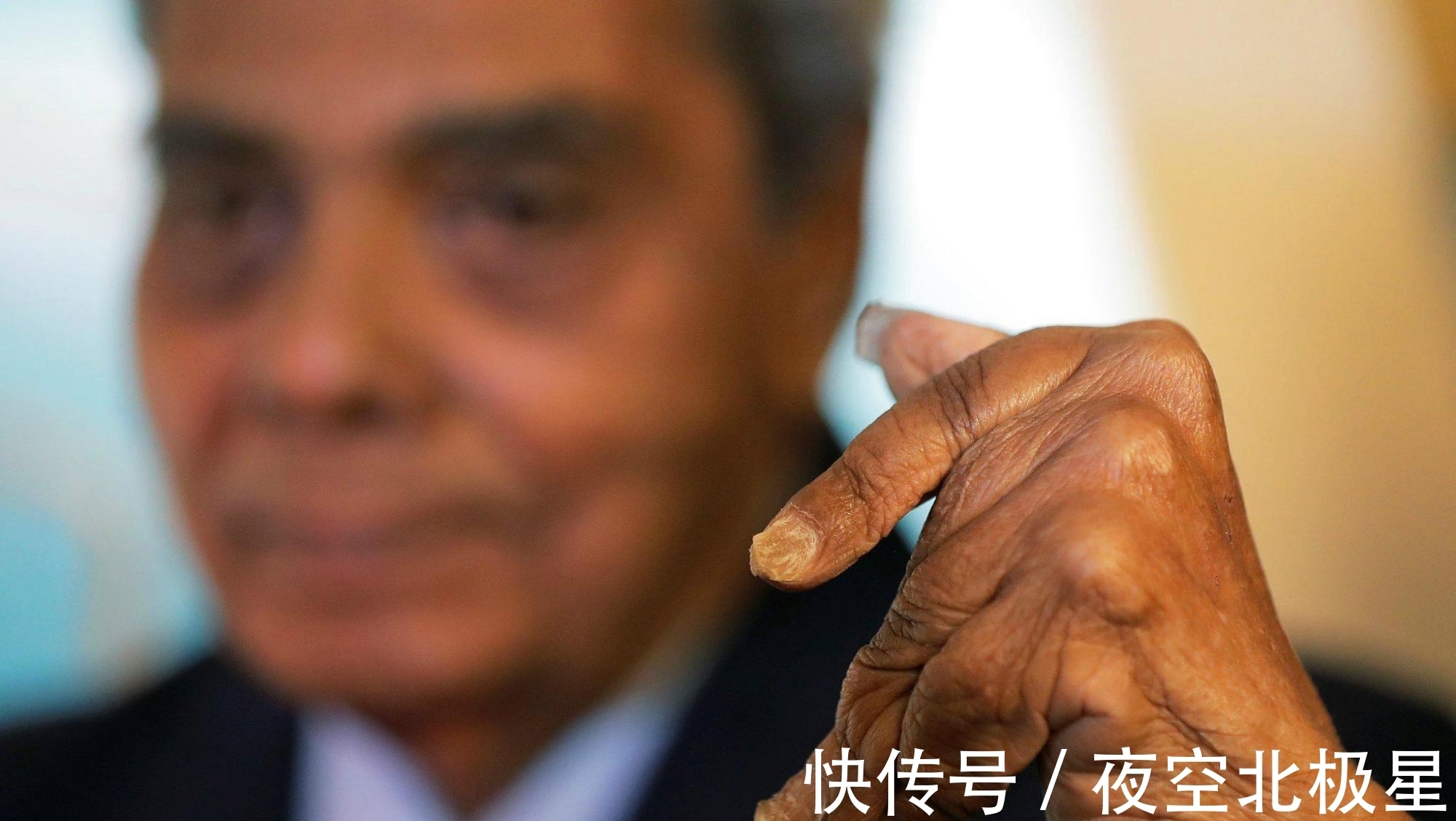 手指|印度大爷留了45年长指甲,剪掉后捐博物馆,不料手指却发生大变化