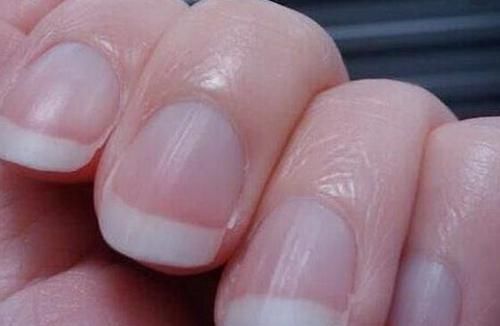 腸胃疾病|腸胃好不好，看手就知道！若你沒有這3個表現，那么就恭喜你了！