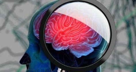 脑梗祸根找到了,医生提醒四类食物吃越多,血管会越堵