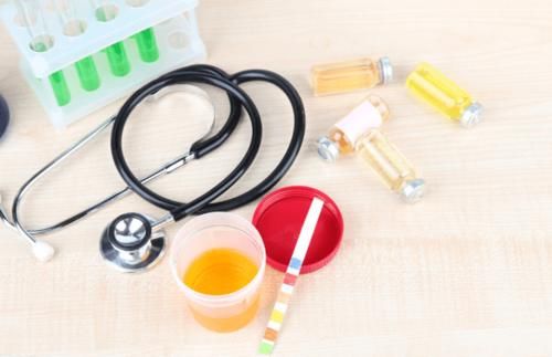 肾穿刺|关于尿蛋白，必须了解的4项问题