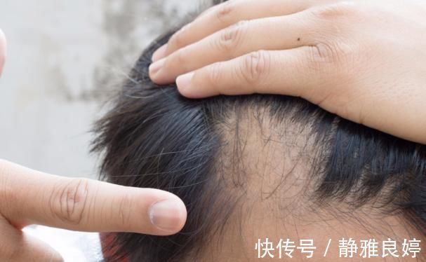 记忆力|男性变老的6大“异常”，若你1个不占，证明身体还很强壮！