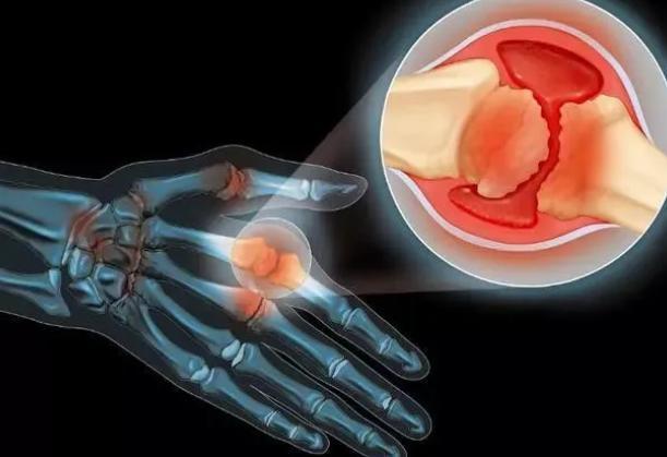 蒲公英|男人,出现5种迹象,说明已经老了,哪怕只占了1个,也要开始保养