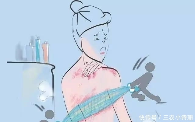 皮肤|你以为洗澡搓出来的是“泥”? 大部分人都搞错了, 看完你还搓澡吗?