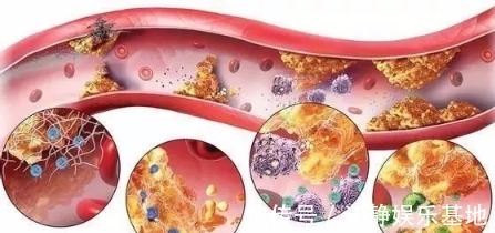 血管堵塞|88岁国医，血管光滑无斑块！他坚持30年的养生二宝，值得借鉴！