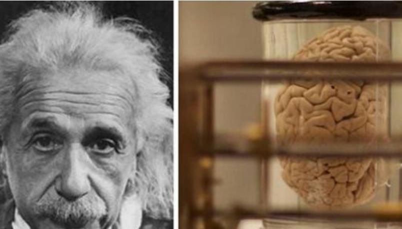 爱因斯坦临终前说了2句话,护士却听错了意思,最后大脑被偷走