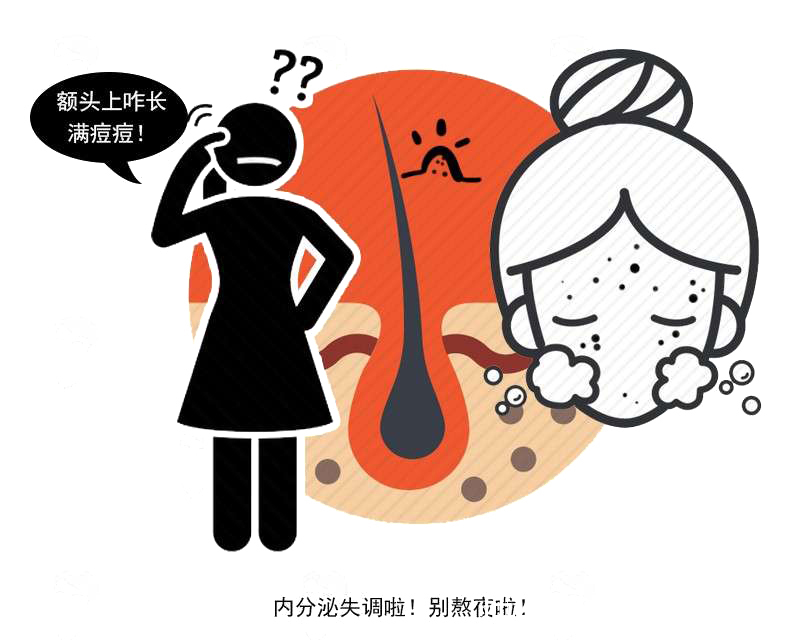 激素水平|为何有人满脸痘，有人却从没长痘呢？背后这些原因，有些却很扎心