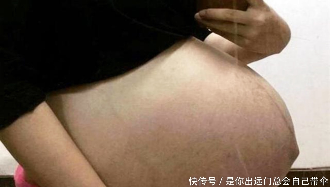 孕妈们|“悬浮肚”你见过吗?网友看完后直呼:看着都觉得疼