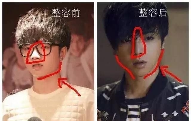 超级男声 华晨宇的外貌为什么感觉变了很多?