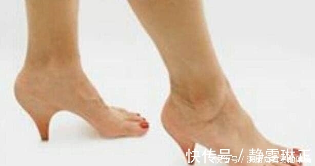 创意 创意鞋子太奇葩：第一双是权贵象征，最后一双让人无语！