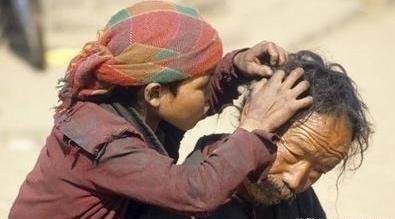 为何30年前农村几乎男女都有虱子,现在怎么没了虱子是哪来的