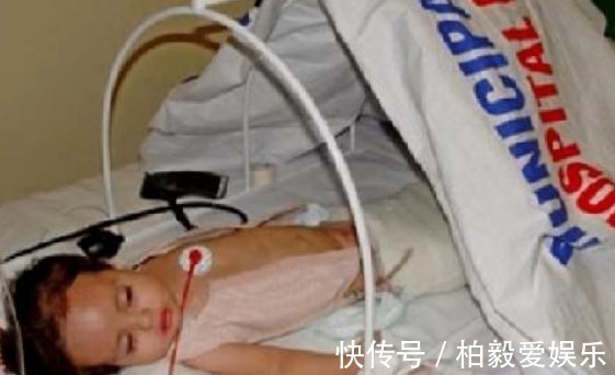 综合症|女童出生便患有美人鱼症,喜欢在水里的感觉,用乐观战胜缺陷