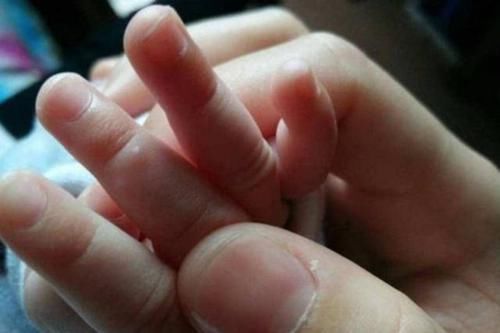 孩子这3个部位越“短”,长大个子越矮!宝妈们早知早受益