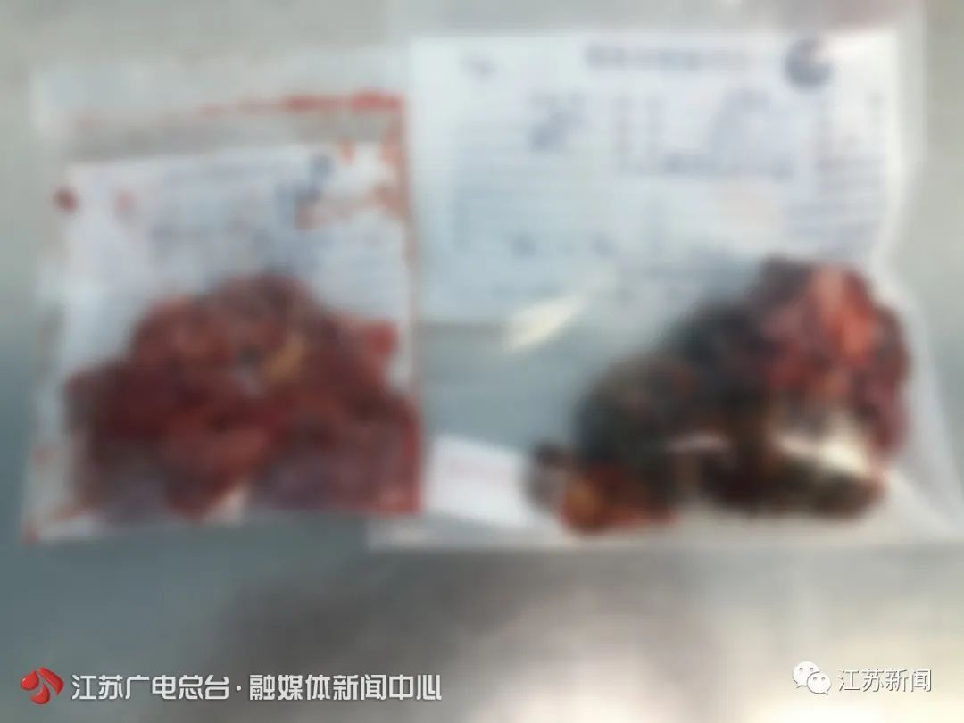 女子胸部取出1000毫升变质物只因25年前一个冲动的决定…