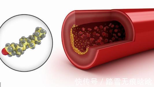 紅黃綠白黑|心血管專家提醒：想降血脂，牢記一、二、三、四、五，紅黃綠白黑