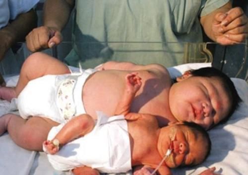 胎儿|一张图带你看,出生时5斤和8斤的娃大小差异多大!心疼下孕妇吧