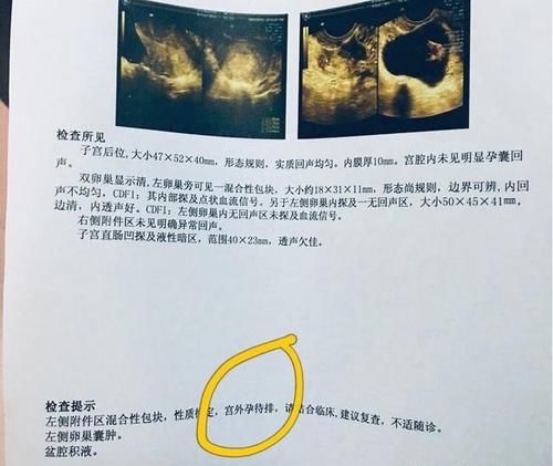 孕早期不会看HCG？这篇文章告知你答案