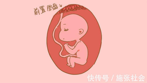 产妇|产妇难“顺”又改“剖”,早知道直接剖腹产!这个罪为啥要受?