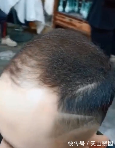 脱发|奇闻:男子秃头了还烫发,看到效果,网友:大叔变小鲜肉