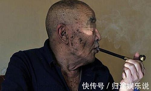 怀孕|4岁女孩肚子1米粗,像怀孕五个月,爷爷却说没事,吃的多胖点好