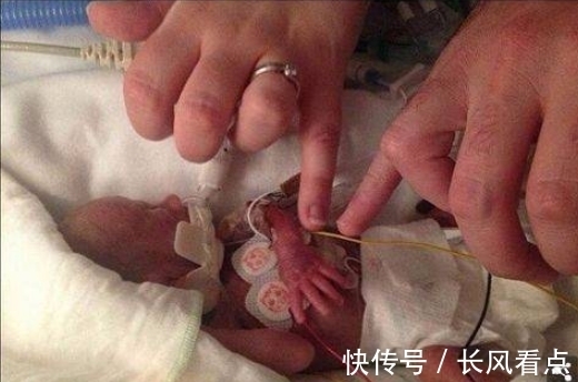 茉莉|生命斗士!出生体重不到1斤,手能穿过戒指,英迷你婴儿长大了!