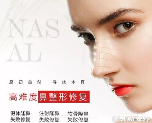 假体|为什么你做的隆鼻没达到预期效果?吸取教训,这些雷别踩!