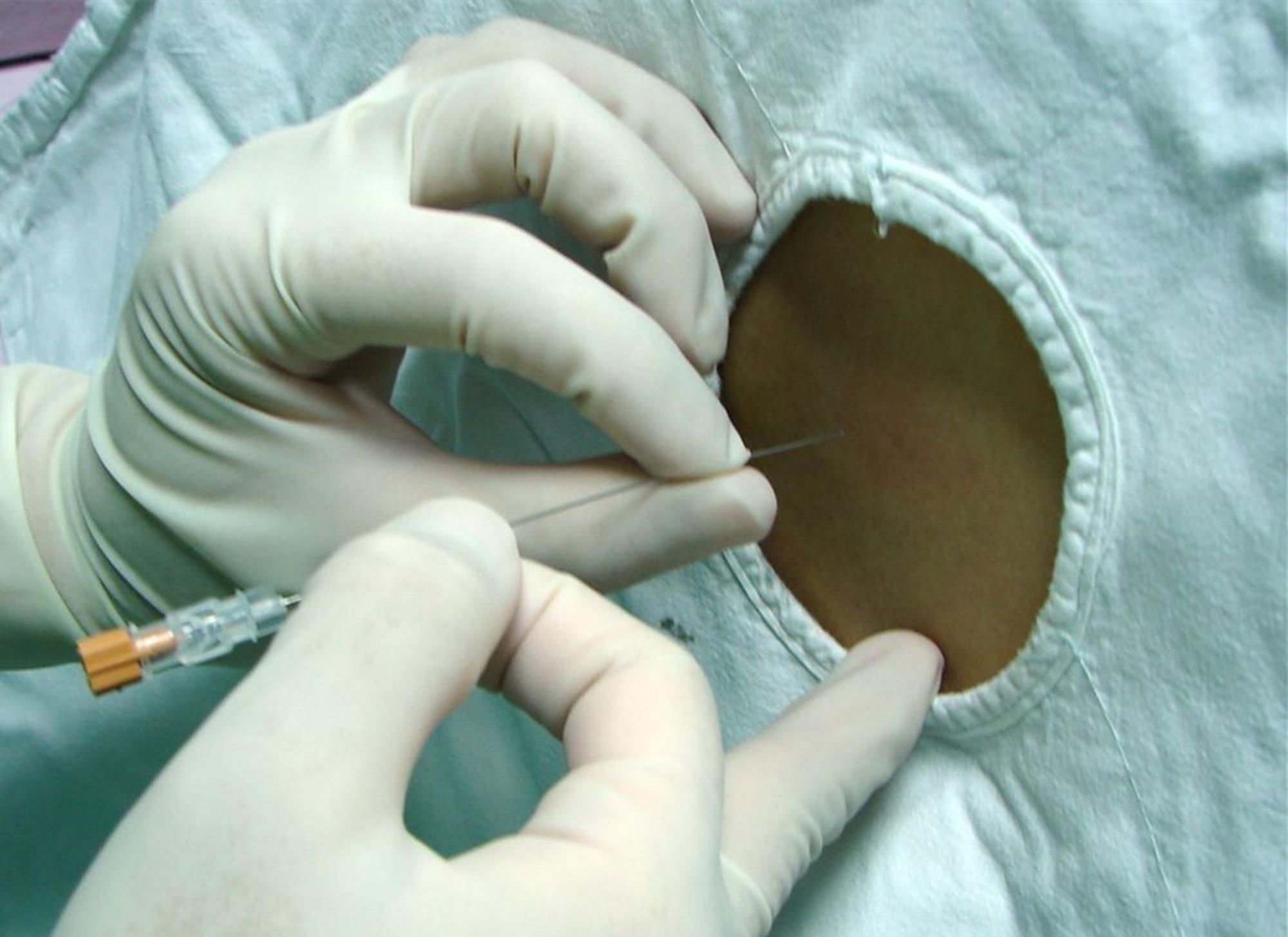 宁愿肚子上留疤,也不愿意顺产,女明星为什么会如此钟爱剖腹产