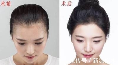 发际线|谁说发际线不够只能刘海来凑?你还可以这样做