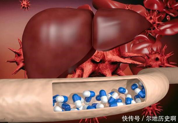 身体|肝癌早期不疼不痒,若是手掌出现这个“信号”,预示体内有癌细胞