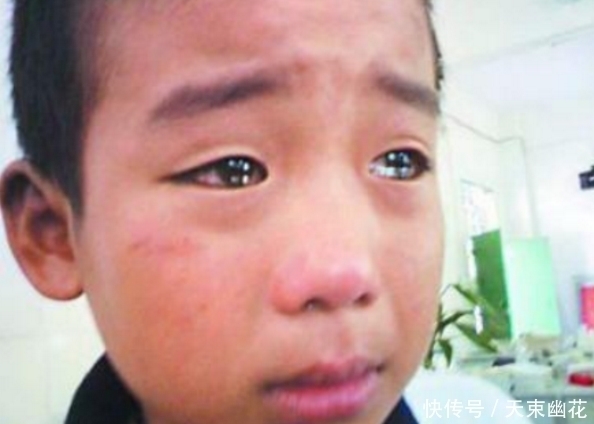 水果|2岁孩子吃了水果有尿毒症,奶奶送去医院,真相让人叹息