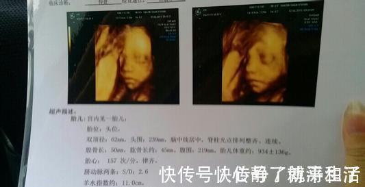 复查率|这是孕妈容易吃亏的产检,也是复查率较高的产检