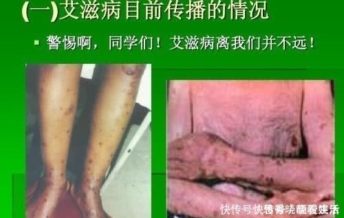 男方|婚检报告男方正常，女方显示HIV呈阳性，医生却只能选择闭嘴瞒着男方