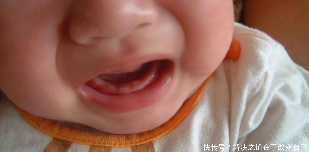 牙床|宝宝半夜发热,宝妈火急火燎送医院,医生扒开嘴一看:可以回家了