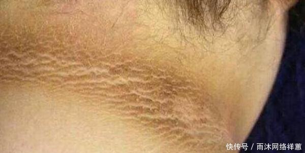 脖子|十岁小男孩脖子一圈发黑洗不掉,听了医生的话后,家长们都笑了