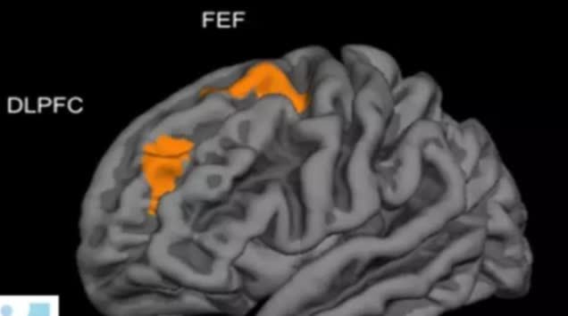 灰质|麻省理工研究发现：孩子大脑发育的最佳方式，并非是靠“阅读”