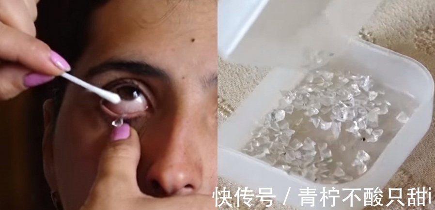 晶体|未解之谜:22岁女孩眼睛流出“水晶”,一天产生50颗晶体