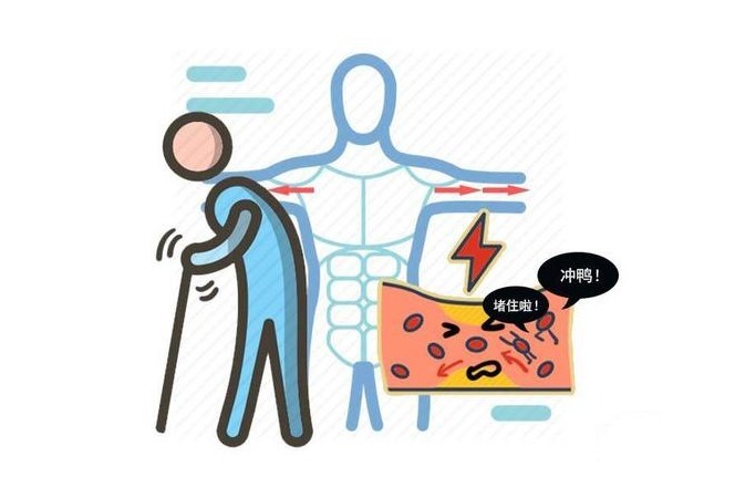 糖原|保护血管饮食有禁忌?平日少吃“2白”,多吃“3黄”,血栓难形成