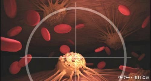 治愈|不化疗也能治愈癌症医生除化疗外，这2个方法治癌也不差