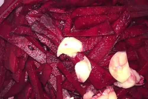 食物|女性担心老太快，三伏天多吃三种食物，排毒淡化色斑，改善睡眠