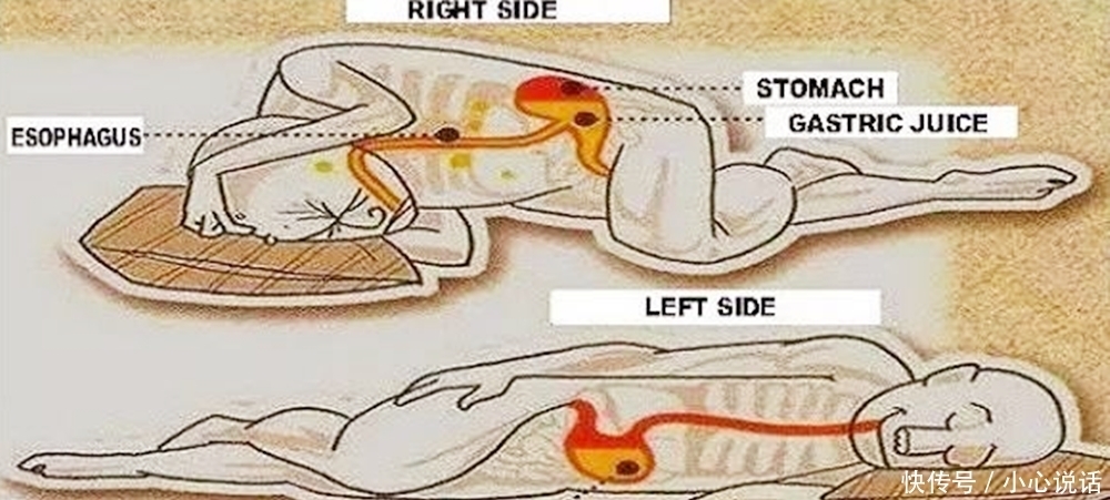 可怕|孕妈长期保持左侧睡，小心宝宝出生后有这个问题！盲目跟风最可怕