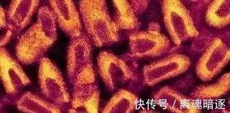 宠物|孩子头上长猫藓怎么办?