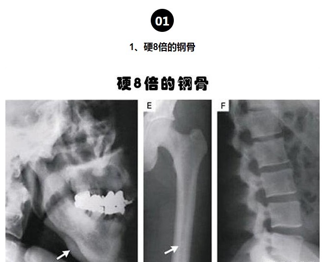 等位基因|罕见的身体特征只有少数人身上才拥有的10个罕见的特征