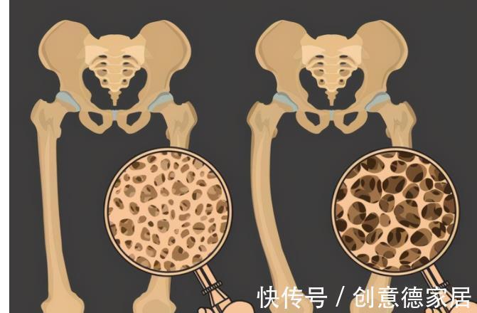 雌激素|都说50岁是女人的一道坎,年龄一到下肢无力全身疼痛就来了,咋办