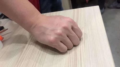 手背上有很多青筋鼓起，是不是血管疾病，原因是3个原因导致