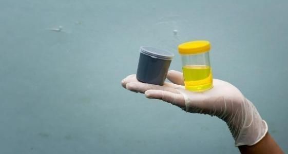 身体比较健康|肝病不能“拖”,如厕时如果有2个现象,可能是肝在向你“求救”