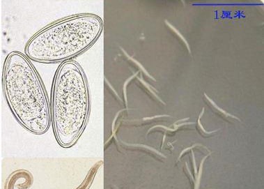 感染|2岁女儿患上“蛲虫病”,得知原因后,宝妈直接气得带孩子回娘家