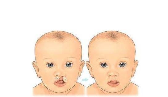 结果|意外怀孕，小两口粗心养胎，产检结果让二人后悔不已