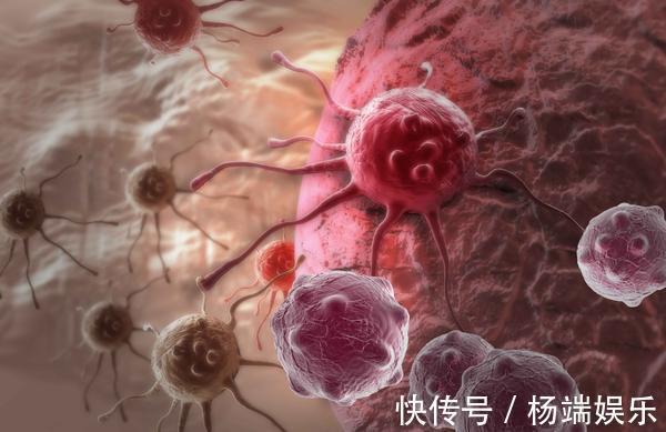 患者|癌症晚期是否要治，是不是不值得治医生说出了大实话！