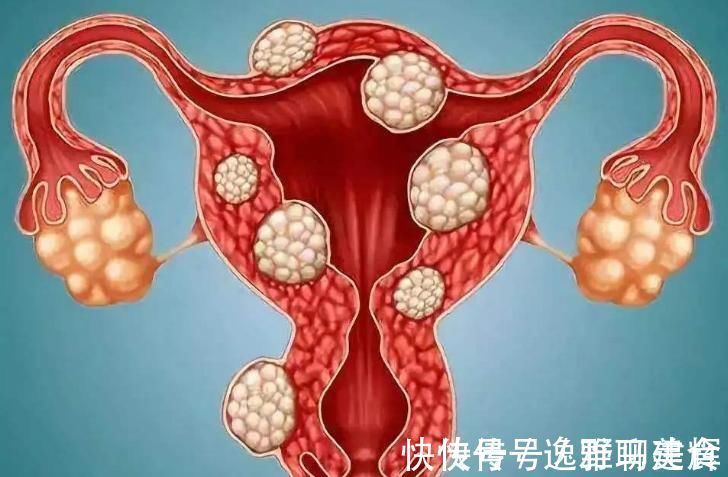 补气|你有“子宫肌瘤”吗？饭前来点“此物”，消除肌瘤，补气益脾胃！