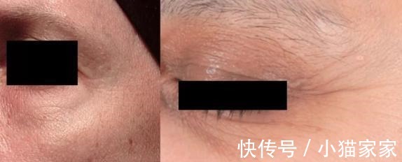 护肤品 哪些皮肤问题是护肤品不能解决的!